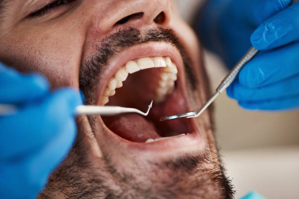 Best Same-Day Emergency Dental Services in Barry, IL