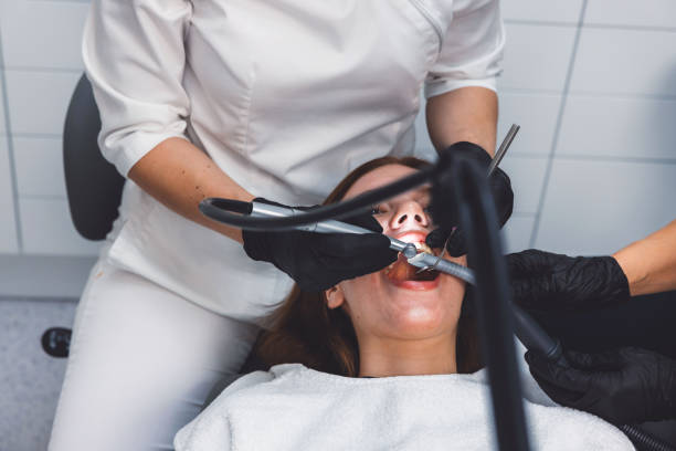 Best Emergency Wisdom Teeth Removal in Barry, IL